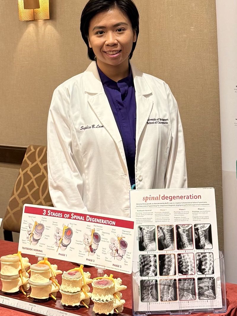 Dr. Sophia Lam, D.C. beside spinal degeneration education displays at her Bayside chiropractic office