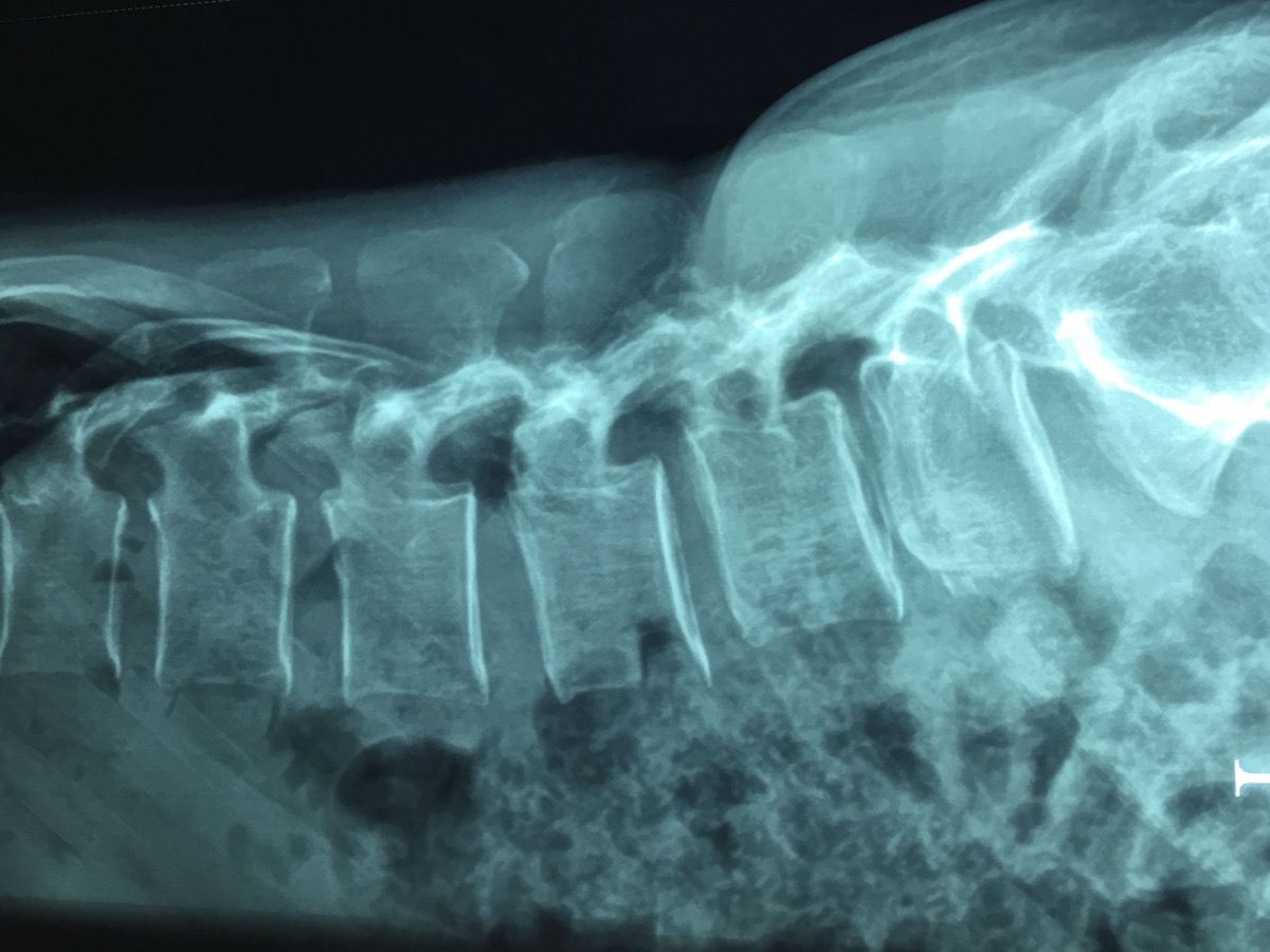 Lateral cervical spine X-ray showing neck vertebrae and disc spaces